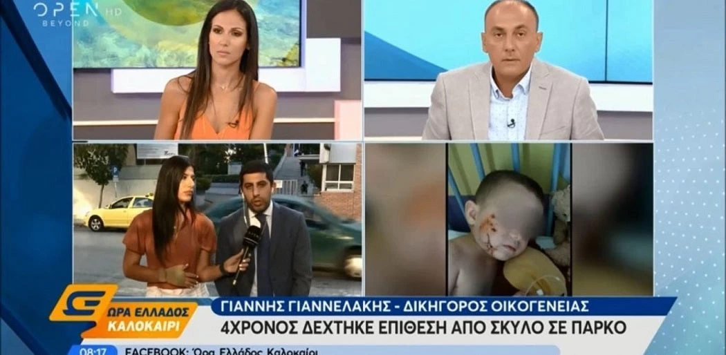 Σκύλος επιτέθηκε σε 4χρονο ενώ έπαιζε σε πάρκο – Του έγιναν 16 ράμματα (βίντεο)